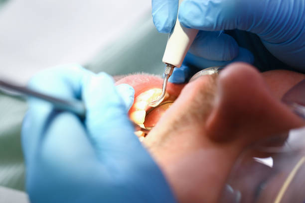 Best Emergency Broken Tooth Repair in Pitman, NJ