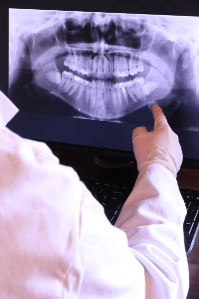 Best Emergency Wisdom Teeth Removal in Pitman, NJ